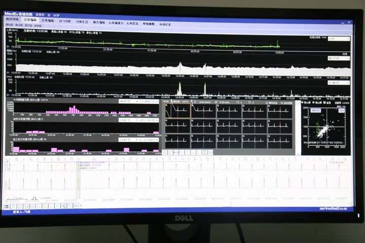 24小时心电分析.jpg