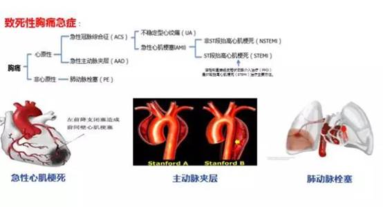 说明:胸痛中心6